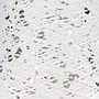 GLITTER MONDIAL 